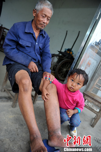 ��սʤ��69���꣺̽�ý��������ս�۶����ܺ�����